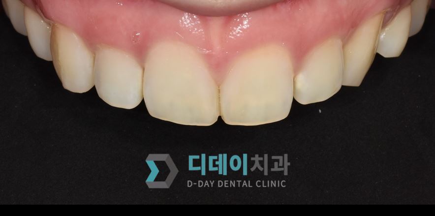 라미네이트 전 사진입니다.