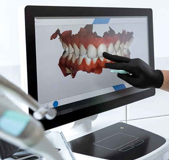 CEREC Primescan 프라임 스캐너 분석
