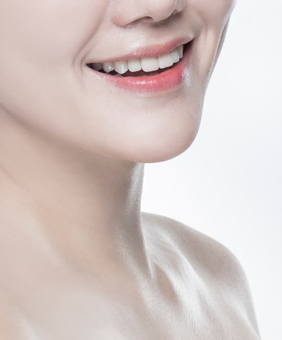 디데이 라미네이트